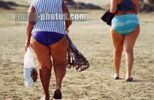 Cellulite