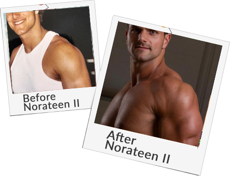 Before after Norateen II